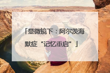 显微镜下：阿尔茨海默症“记忆重启”
